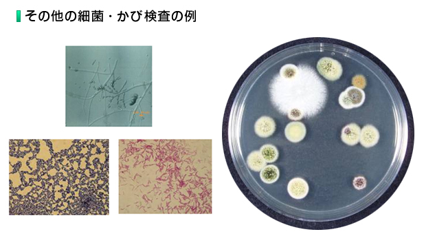 その他の細菌・かび検査